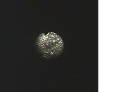 Immagine su monitor attraverso un fibroscopio convenzionale