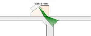 The Solution: Phased Array vs. Conventional Ultrasound