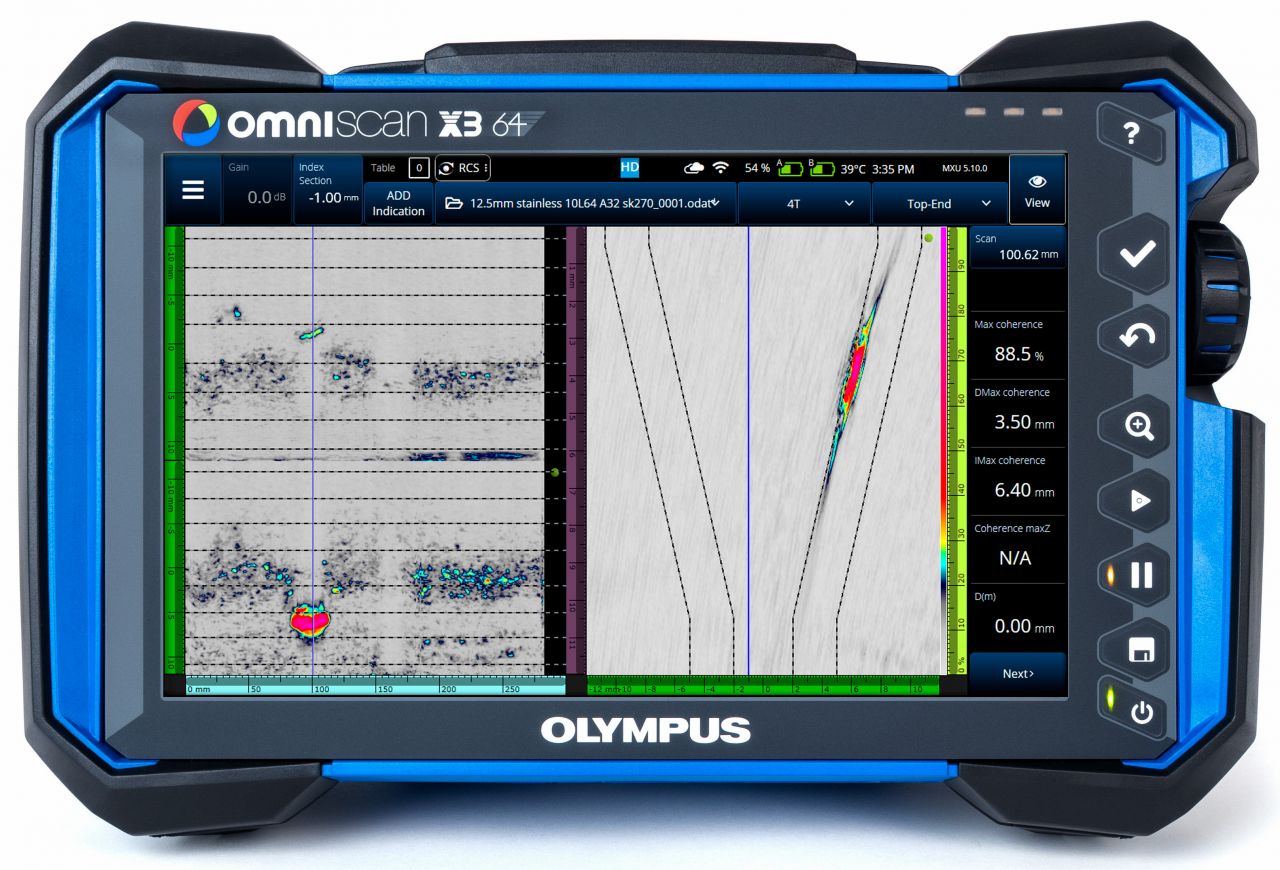 5 Main Advantages of Phase Coherence Imaging (PCI) | Blog Post ...